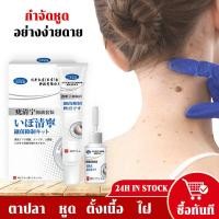 ราคา หูดตาปลาและติ่งเนื้อ กำจัด หูดตาปลา แต้มไฝ ปลอดภัยไม่เจ็บ ไฝกระเนื้อ หูดและติ่ง ครีมไฝ แต้มตาปลา ลอกหูดตาปลา ครีมแต้มหูด (28757783189)