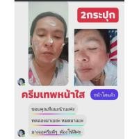 ราคา ครีมหน้าขาวครีมฆ่าสิวครีมเทพหน้าใส (9947264431)