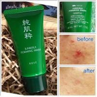 ราคา Kose Junkisui Foaming Wash 30ml. โคเซ่ โฟมล้างหน้า สำหรับผิวผสม-ผิวมัน ผิวเป็นสิว (18330147553)