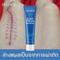 ราคา eelhoe ครีมลดรอยแผลเป็น ยาทาแผลเป็น ลบรอยแผลเป็น แผลผ่าตัด แผลไฟไหม้ น้ำร้อนลวก รอยสิว ครีมลบรอยแผลเป็น ครีมทาแผลเป็น (20932553466)