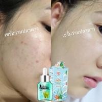 ราคา เซรั่มว่านปลาดาว (1222837326)