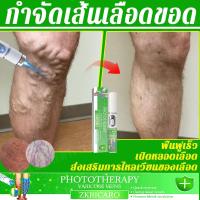 ราคา เลเซอร์รักษาเส้นเลือดขอด ส่งเสริมการไหลเวียนโลหิต รักษาเส้นเลือดขอด ลดเส้นเลือดขอด ปรับปรุงเส้นเลือดขอด ขาบวม เลเซอร์เส้นเลือดขอด (41604280005)