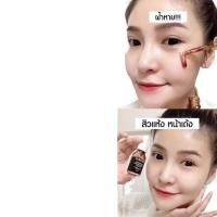 ราคา ❈❖◆เซรั่มสตอ YERPALL ลดรอยสิว หน้าใส “ลอตใหม่” ของแท้ 100% มีhologram #ส่งฟรี ‼️รับตรงจากบริษัทเอง! (12462330913)