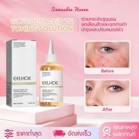 ราคา EELHOE กรดไกลโคลิก 7% โทนเนอร์กรดอัลฟาไฮดรอกซี โทนเนอร์ขจัดสิว โทนเนอร์ ลดเลือนสิว สดชื่นและให้ความชุ่มชื้น ปรับสมดุลน้ำ (41762090451)