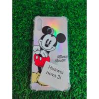 ราคา เคส​กันกระแทกลายลิขสิทธิ์​ huawei nova3i​(หัวเหว่ยโนว่า3i)​ขอบนิ่ม (6153233689)