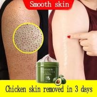 ราคา Niacinamide Shea Butter Body Scrub Chicken Skin Removal Dead Skin Remover Exfoliating Make Skin Smoother And Whiter 250g (44101973694)