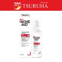 ราคา แอคเน่-เอด มอยซ์เจอร์ไรซิ่ง โลชั่น ออยล์ คอนโทรล 30 มล./Acne-Aid Moisturising Lotion Oil Control 30 ml. (29453134079)