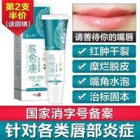 ราคา Cleavage lip Throat Peeling and Peeling repair Lip balm peปาก pailig皮 ไข้อักเสบอักเสบ เรื้อรัง (43872472849)
