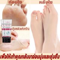 ราคา รักษาผิวเท้าแห้งแตก ครีมทาตาตุ่มดำ aichun ครีมทาเท้าดำ ครีมทาตีนขาว (14507560193)