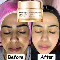 ราคา ครีมไวท์เทนนิ่งสําหรับผิวหน้า Melasma Cream Dark spot remover 377 美白 de Toiletteade กําจัดฝ้ากระกระจ่างใส ยับยั้งองค์ประกอบเมลานิน 30g (41271258081)