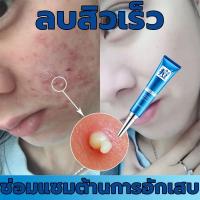 ราคา พร้อมส่ง！！ GISEELAN Acne cream ครีมรักษาสิว ครีมลดรอยสิว ครีมหน้าขาวใส ครีมแต้มสิว รักษารอยสิว สิวอุดตัน (13222866171)