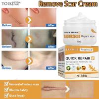 ราคา ครีมลบแผลเป็น 50g ครีมลดรอยแผลเป็นลดแผลไฟไหม้แผลน้ำร้อนลวกแผลผ่าตัดเป็นต้นแผลเป็นหลายประเภทยาลบลอยแผลเป็นครีมลดแผลเป็น ครีมลบรอยแผลดำ ครีมกำจัดแผลเป็นครีมลดรอยสิว รอยแผลเป็น แผลเป็น ครีมรักษาแผลเป็น เ