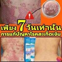 ราคา ครีมลดอาการคัน 20g ทาแก้คัน สารสกัดจากพืชใช้ได้ กลากเกลื้อน เชื้อรา ผลิตจากธรรมชาติ ใช้ทาผิวหนังทุกชนิด (44461550822)