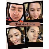 ราคา ครีมชาร์มมิ่งสกินลดสิว ลดฝ้าช่วยปรับสภาพผิวให้กระจ่างใสขึ้น (18535241346)