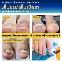 ราคา คู่มือดูแลเล็บขบเล็บเชื้อรา พร้อมคลิปเรียน (29917768550)