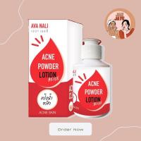 ราคา Acne powder lotion แป้งน้ำทาสิว AVA NALIรักษาสิวอักเสษสิวอุดตัน บริเวณใบหน้า สิวหลัง (9888872839)
