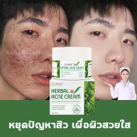 ราคา ครีมลดสิว ครีมรักษาสิว ELAIMEI Acne Aid แต้มสิว สิวอุดตัน สิวผด กำจัดสิว รักษารอยสิว ครีมลดรอยสิว รักษาสิวหลัง (11016432839)