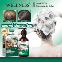 ราคา Jaysuing แชมพูน้ำมันกระเทียม แชมพูป้องกันผมร่วง Garlic ยาสระผมรังแค คันศีรษะ ยาสระผมเชื้อรา แชมพูรักษารังแค shampoo (26480654294)