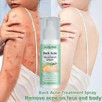 ราคา หลังเนียน! JAYSUING สเปรย์สิว ฉีด สิว หลัง ครีมแต้มสิว สเปย์ฉีดสิว รักษาสิว ลดสิวหน้าอก สิวที่หลัง ที่ลดสิว 120ML (22389725566)