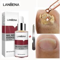 ราคา LANBENA Original Nail Repair Essence Serum Fungal Nail Treatment (40704521344)