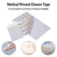 ราคา เทปปิดแผลทางการแพทย์หมันปฐมพยาบาลกาวปิดแผลรวมทั้งการตกแต่งหลังคลอดแผลซ่อมแซมผิว (25996833233)