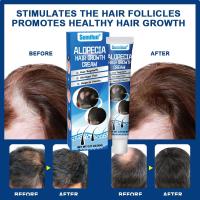 ราคา ️จัดส่งทันที️ ยาปลูกผมของแท้ น้ำยาเร่งผมยาว เร่งผมยาว น้ำยาปลูกผม เซรั่มปลูกผม ป้องกันผมร่วง บอกลางความบาง บำรุงผม (27857962567)