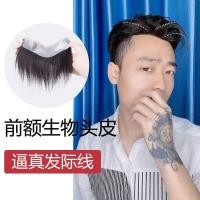 ราคา ผมสายเปลี่ยนทอมือเปลี่ยนชิ้นวิกผมผู้ชายหัวล้านด้านบนจอนวิกผมจริงผมผู้ชายชิ้นหน้าผากเปลี่ยนชิ้น (27143605821)