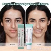ราคา Centella Asiatica Spot Removal Cream Age Spot Remover for Face 40ml Burn Scar Removal Cream Care Brightening Repair wsdmy (47401741640)