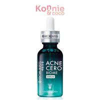 ราคา Rojukiss Acne Cero Biome Serum 30ml ผลิตภัณฑ์บำรุงผิวหน้าสำหรับผู้มีปัญหาสิว ผิวมัน รอยสิว ไม่เป็นสิวง่ายอีก. (23343568694)