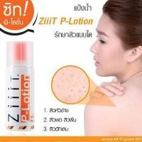ราคา #ZiiiTโลชั่นบำรุงผิว ซิท สำหรับผู้มีปัญหาสิว ZiiiT P-lotion แป้งน้ำแต้มสิว สิวผด สิวผื่น 50 มล. (7754258079)
