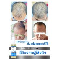 ราคา สิรแฮร์โทนิคดูแลผมร่วงเร่งการเกิดใหม่ด้วยสารสกัดจากธรรมขาติหญ้าถอดปล้อง ทองพันชั่ง อื่นๆ30กรัม ราคา139 บาท มีเก็บปลายทาง (29611820557)