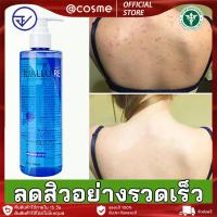 ราคา สบู่ลดสิว สบู่สิว สบู่สิวหลัง สกัดจากสมุนไพรจีน กำจัดไร กำจัดสิว ทำความสะอาดรูขุมขน ซ่อมแซมผิว ป้องกันการเกิดซ้ำ (24401388921)