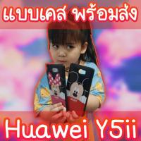 ราคา ✨พร้อมส่ง✨เคสHuawei Y5ii เคสมือถือพร้อมส่ง หัวเหว่ย Y5II (caseiallphone) (5746769797)