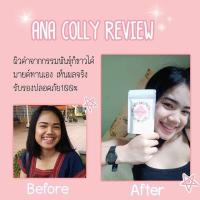 ราคา Ana Colly collagen (1111588969)