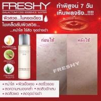 ราคา น้ำตบ Freshy Galactomyces Essence Water 80% (6158980992)