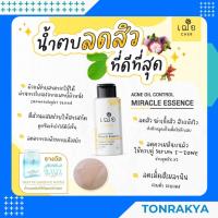ราคา (สูตรอ่อนโยนพิเศษ) เวชสำอาง Cher Acne Oil Control Miracle Essence oil free เฌอ เอสเซ้นส์ น้ำตบลดสิว สิวยุบไว รอยจางไว (10701346677)