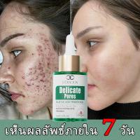 ราคา เซรั่มลดสิว เซรั่มกรดซาลิไซลิก 30ml คุมน้ำมันยับยั้งสิว มีกรดซาลิไซลิกช่ว ควบคุมการผลิตน้ำมัน ลดรูขุมขน เติมความชุ่มชื้น (53600854156)