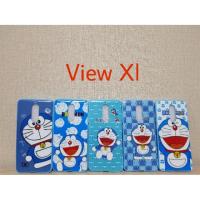 ราคา เคส wiko view XL (866352796)