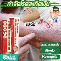 ราคา 【2025 แบบใหม่】ครีมรักษาโรคสะเก็ดเงิน ครีมทาผิว ครีมลดอาการคัน ทาแก้คัน สำหรับผู้ที่มีผิวแห้ง คัน ช่วยลดการอักเสบ ลดรอยแด (28679414349)