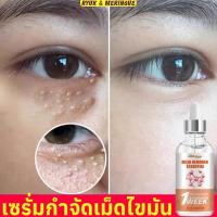 ราคา อายครีม กำจัดเม็ดไขมันใต้ตา ครีมทาเม็ดไขมันใตตา ลดเลือนริ้วรอยความหมองคล้ำปรับปรุงถุงใต้ตา อายเซรั่ม (26788667399)