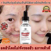 ราคา เซรั่มแต้มสิ เซรั่มกระชับรูขุมขน 30ml รูขุมขนกระชับ รักษาสิว ไม่ระคายเคืองผิว รูขุมขนกระชับ รักษาสิว ลดรอยแดง (49953713316)