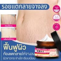 ราคา ครีมทาท้องลาย รอยแตกลาย ลดรอยแผลเป็น ลดรอยแตกลาย ท้องลาย ริ้วรอยจากการตั้งครรภ์ Stretch Mark Cream 30g ครีมบำรุงผิว (27677431456)