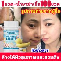 ราคา คลอรีนเม็ด ผสมน้ําอาบ อาบน้ำแล้วไม่แพ้ ผดผื่นอีกเลย ผงคลอรีน แก้แพ้น้ำคลอรีนน้ํา คลอรีนผง ไวท์เทนนิ่งผ คอรีน คลอรีนก้อน (18494318371)