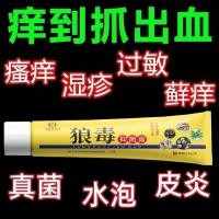 ราคา 2025 สินค้าใหม่หมาป่าพิษแบรนด์เก่าครีมป้องกันอาการคันต้านเชื้อแบคทีเรียทั้งร่างกายป้องกันอาการคันครีมป้องกันอาการคันภายนอกยู20260106 (52954186575)
