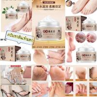 ราคา ครีมทาส้นเท้าแตก เท้าหยาบกร้าน แก้เท้าแตก เท้าลาย ส้นเท้าแตก (3033896824)