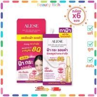 ราคา (กล่อง 6 ซอง) Alese Dark Spot And Anti-Melasma ครีมเนื้อเซรั่ม เซรั่มทาฝ้า (ปริมาณ 7 กรัม) (26941957018)