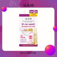 ราคา ALESE Dark Spot and Anti Melasma Concentrate Cream อะลิเซ่ครีมทาฝ้า 7g. (11060306052)