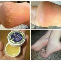 ราคา พร้อมส่ง ครีมทาส้นเท้าแตก Cococare Repairs and Conditions Dry Cracked Heels 11g ครีมทาเท้า (10721843707)