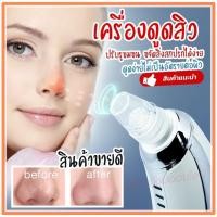 ราคา เครื่องดูดสิวเสี้ยน KM-1867 อุปกรณ์ดูดสิวเสี้ยน กำจัดสิวเสี้ยนจมูก ดูดสิวที่จมูก แรง 3 ระดับ/ เครื่องล้างหน้าแบบซิลิโคลน (14989262515)