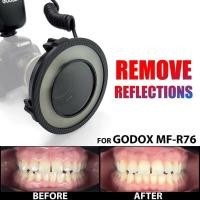 ราคา Godox รูปถ่ายฟิลเตอร์โพลาไรซ์สำหรับ MF-R76กล้องถ่ายภาพทันตกรรมแบบสะท้อนและไม่มีแสงสะท้อน อุปกรณ์เสริ (41608717328)